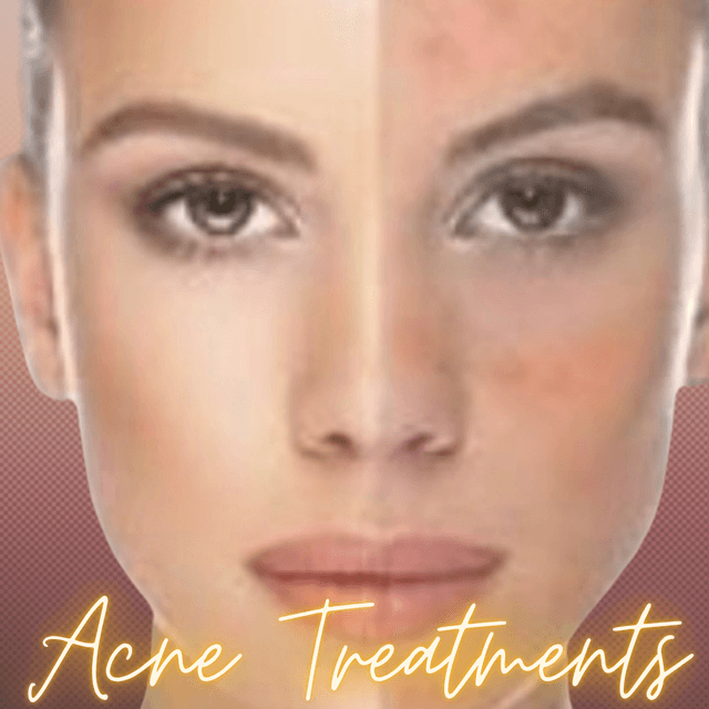 ClearSkin 12wk Adios Acne Program
